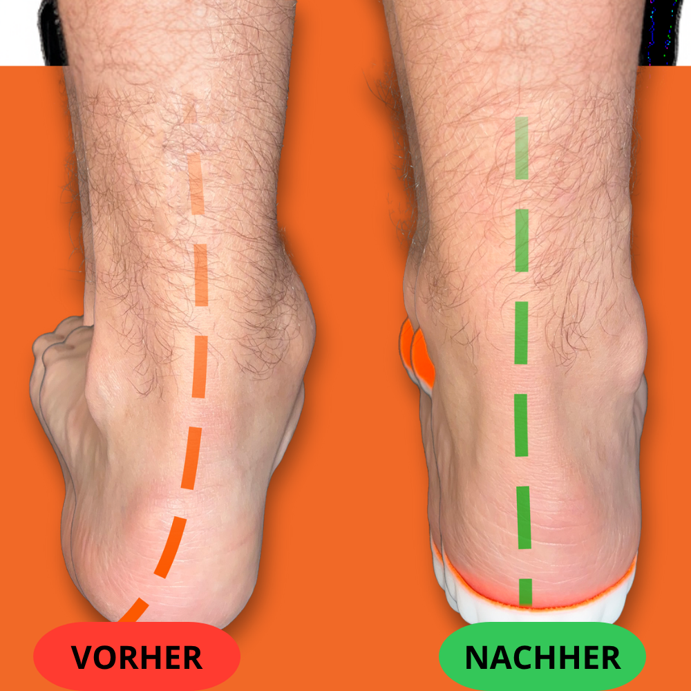 Sport-Latex-Einlegesohlen-OrthoStep™ Germany